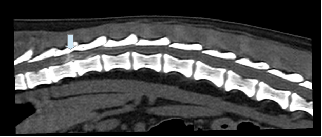 ct15